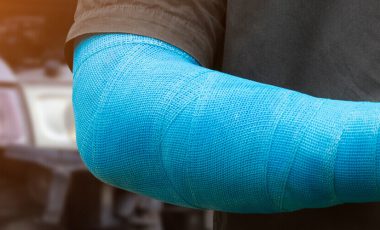 medical payments coverage men wear cloth splint on arm to treat car accident injuries